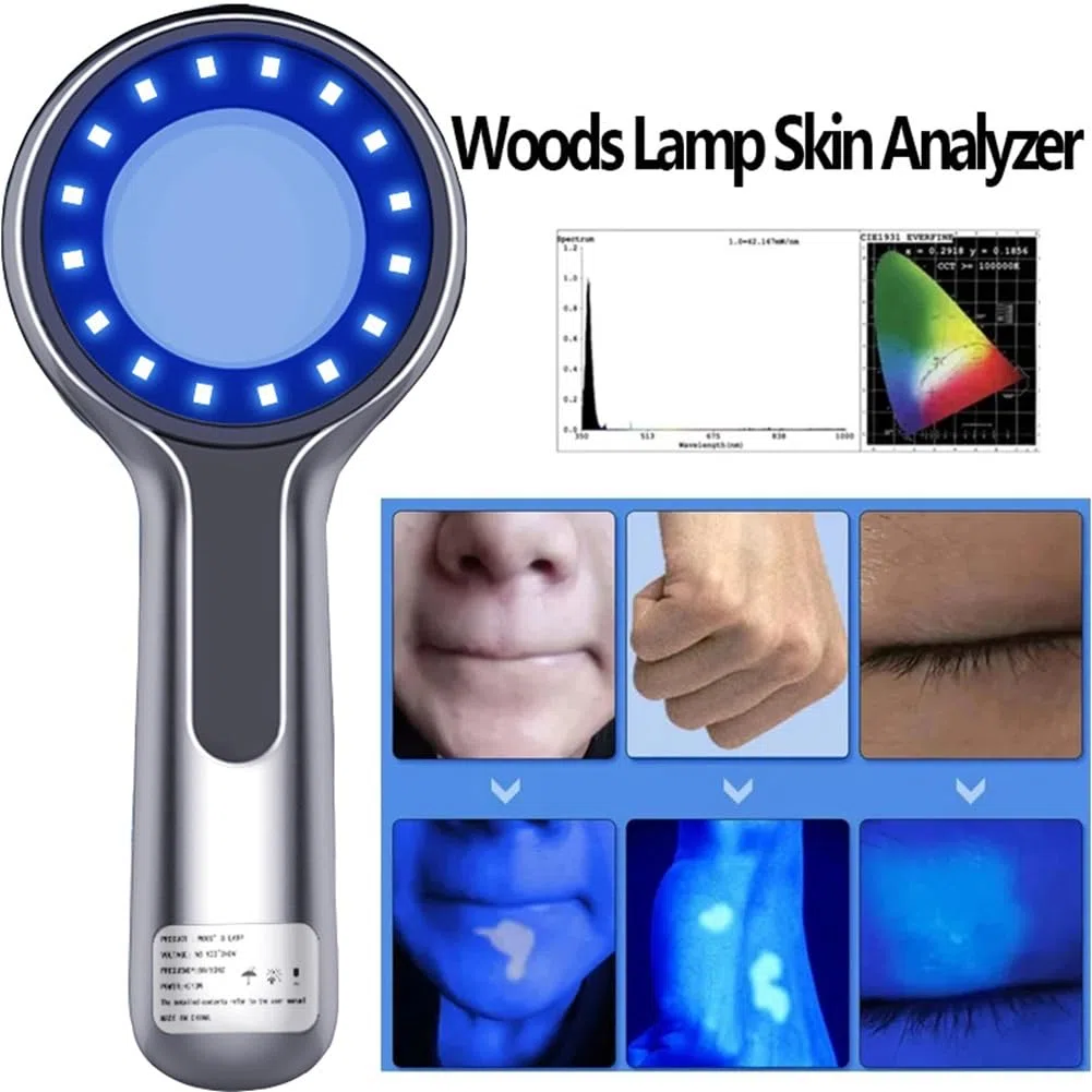 Woods Lampe Hautanalysator Haut UV-Vergrößerung für Schönheit Gesichtstests Lampe Licht für Hautpflege Analyse Tests